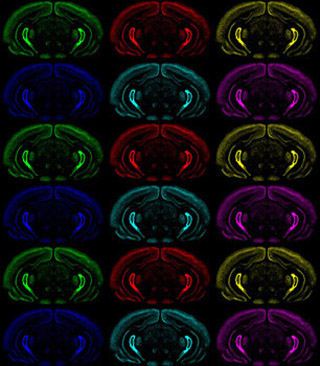 A multicolored montage of coronal sections of brains.