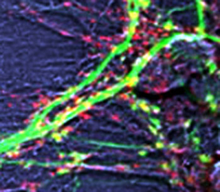 Neurons grown in culture and labeled to measure plasticity in a living system.