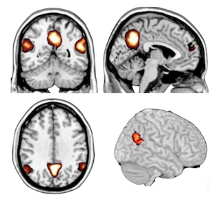 fMRI image of regions in the brain used in assessing intent.