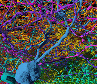 Colorful neurons are tangled around each other. 